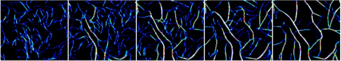 New protein function could explain cause of neurological disease New protein function could explain cause of neurological disease